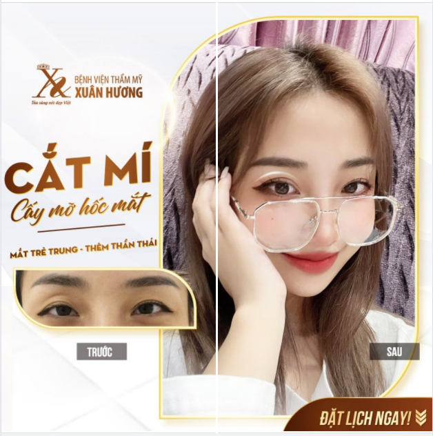 ĐỪNG ĐỂ HỐC MẮT TRŨNG SÂU KHIẾN BẠN "GIỪ" TRƯỚC TUỔI!