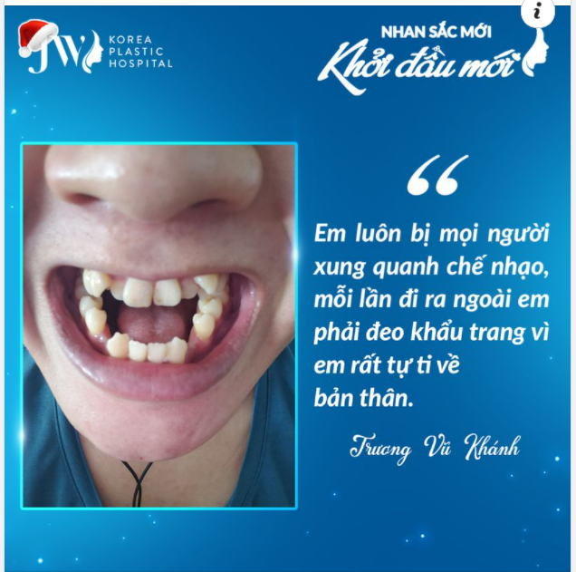 “Em luôn bị mọi người xung quanh chế nhạo, mỗi lần đi ra ngoài em phải đeo khẩu trang vì em rất tự ti về bản thân”