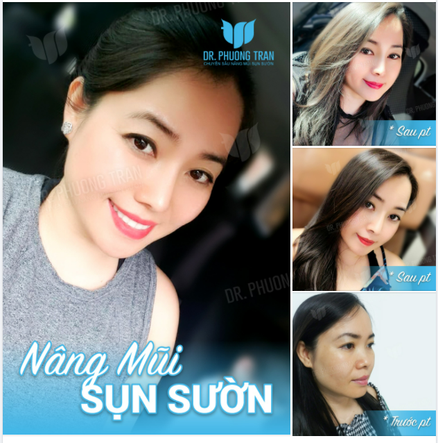 Em tươi như màu nắng Liệu có làm anh lo lắng