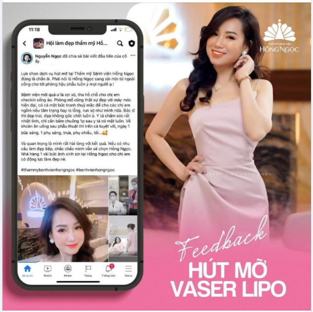 HÚT MỠ TẠI THẨM MỸ BỆNH VIỆN HỒNG NGỌC ĐÚNG LÀ CHÂN ÁI!!!