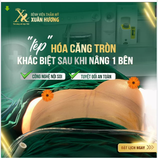 KHÁC BIỆT RÕ RỆT GIỮA "LÉP" VÀ "CĂNG TRÒN"