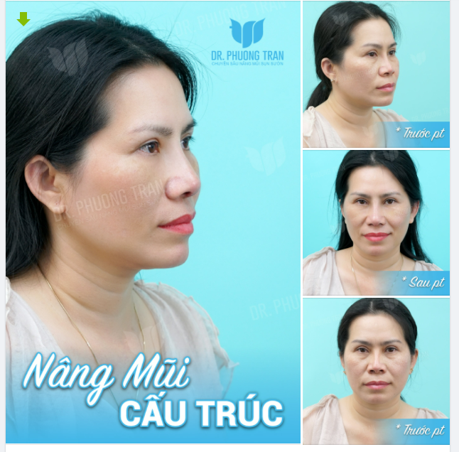KHÔNG NGỜ TRẺ RA ĐƠN GIẢN ĐẾN THẾ