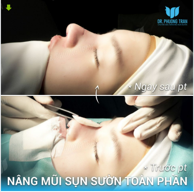 Không quan trọng ai thương, phụ nữ chỉ cần “THƯƠNG” chính mình.
