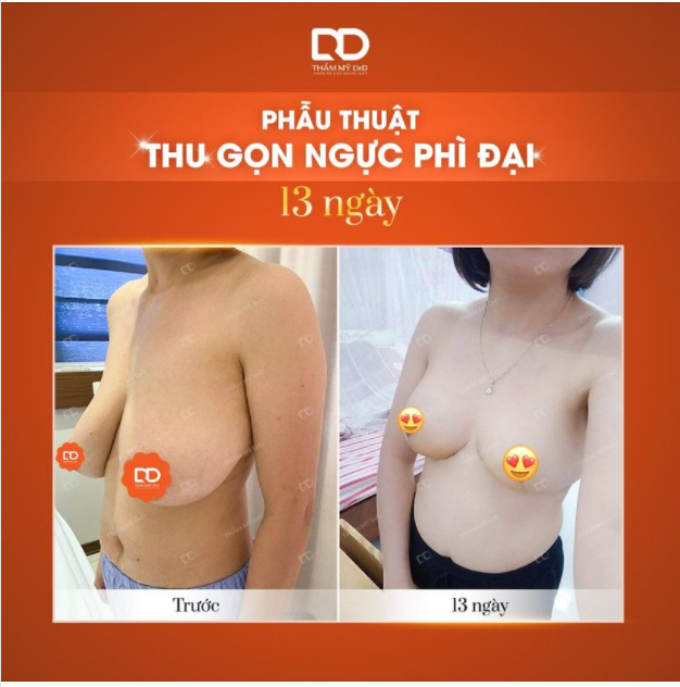 Là 1 người hay không phải là một người?