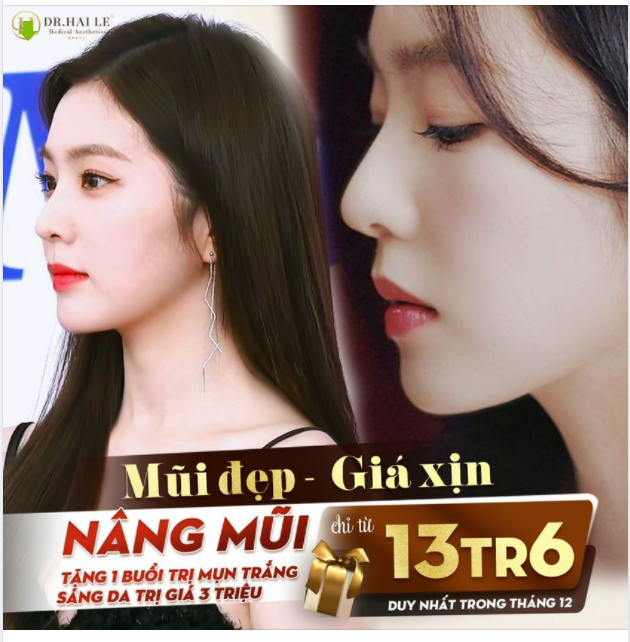 Làm đẹp thả ga - ngại chi về giá MŨI CỰC "CHẤT" - SALE CỰC HOT