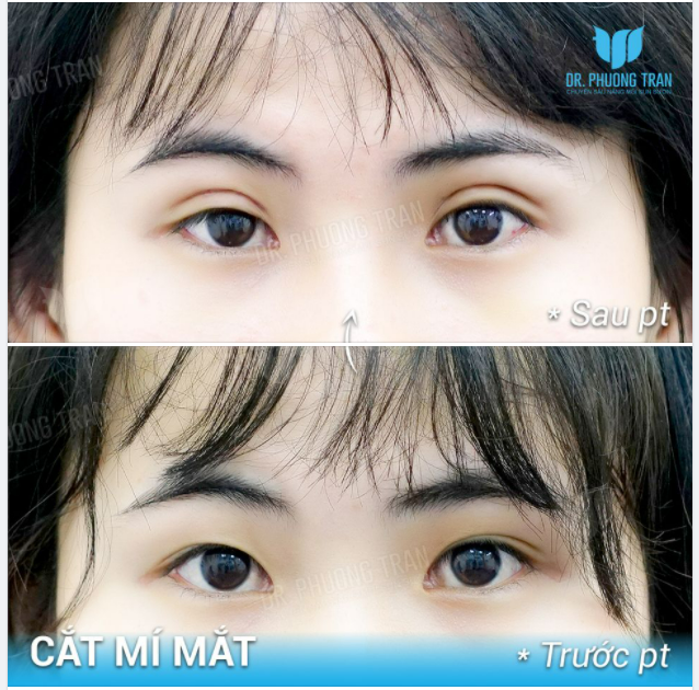 LÀM MẮT 2 MÍ, ĐÓN TẾT XINH HẾT Ý