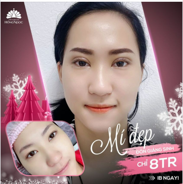 MÍ ĐẸP ĐÓN GIÁNG SINH CHỈ TỪ 8TR Đừng bỏ lỡ