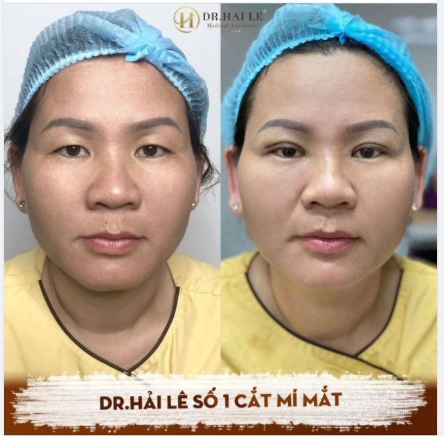 MÍ SẮC NÉT, MẮT ĐẸP XINH.!