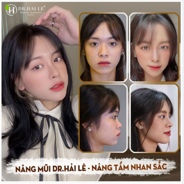 MŨI CAO SANG - HIỆN ĐẠI - TỰ TIN TRONG MỌI KHUNG HÌNH