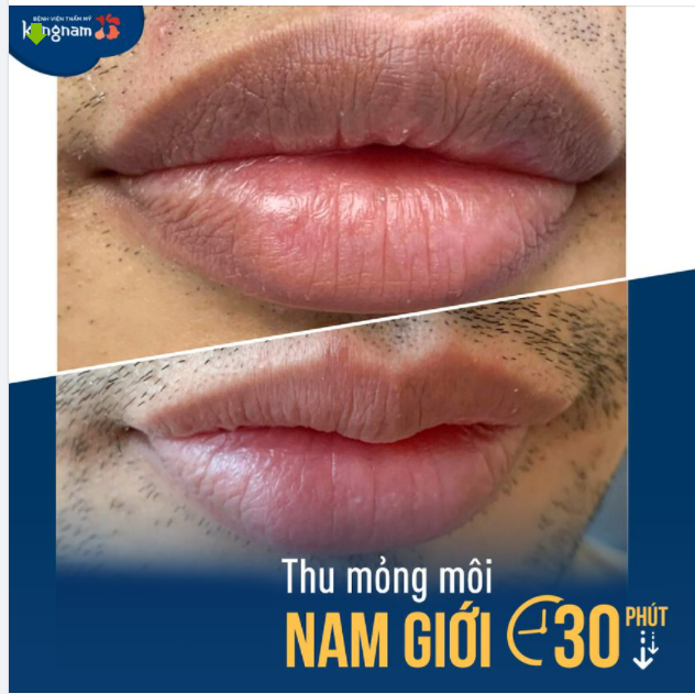 Nam giới THU MỎNG MÔI tại sao không?