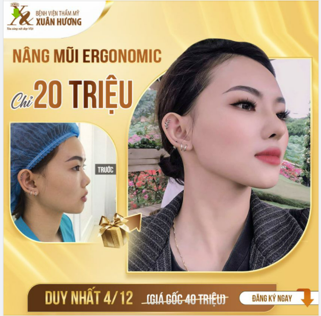 NÂNG MŨI ĐÚNG THỜI ĐIỂM - HƯỞNG TRỌN ƯU ĐÃI GIÁ TỐT NHẤT