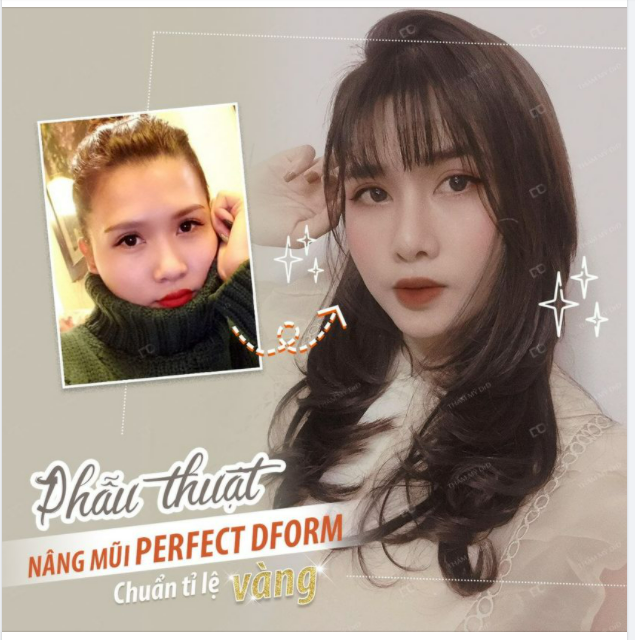 Nâng mũi Perfect Dform không chỉ đủ điều kiện của dáng mũi chuẩn tỷ lệ vàng mà còn đáp ứng đủ các tiêu chí khác: