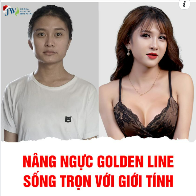 NÂNG NGỰC GOLDEN LINE THAY ĐỔI CUỘC SỐNG THẾ NÀO?