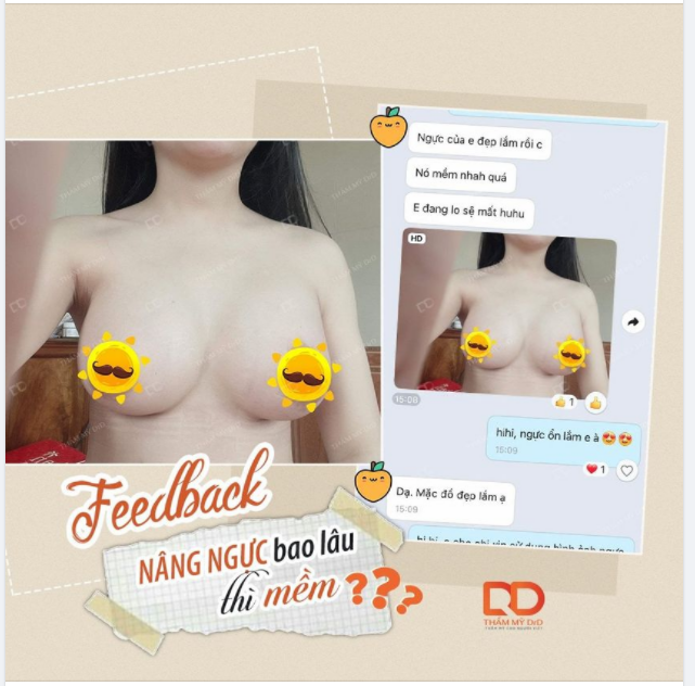 Nâng V1 xong ngực mềm nhanh quá cũng trở thành "nỗi lo" của khách hàng.