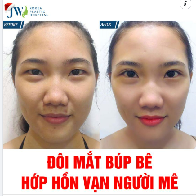 NGỠ NGÀNG ĐÔI MẮT TO TRÒN LONG LANH NHƯ BÚP BÊ ĐẸP TỰA SƯƠNG MAI, AI NHÌN CŨNG SAY