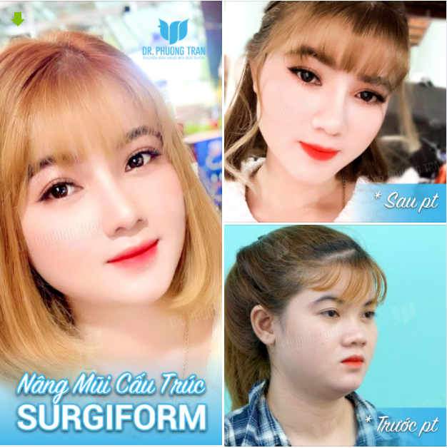 Nhưng vì em quá tuyệt Nhìn đâu thì anh cũng duyệt!