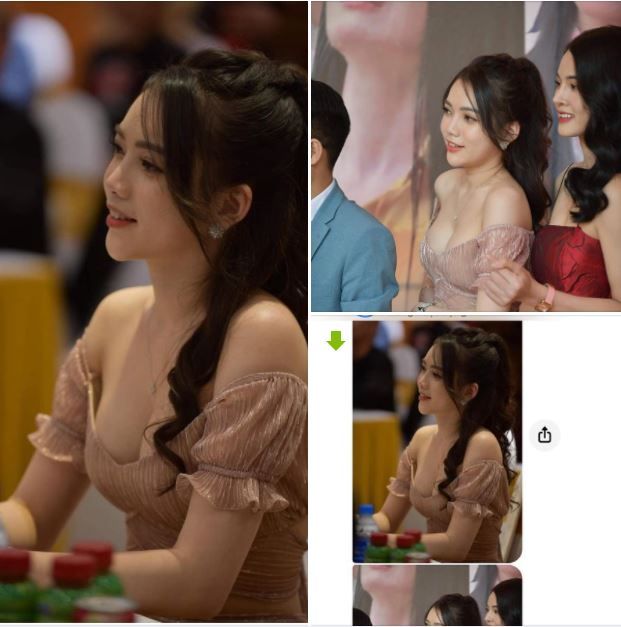 Feedback của khách làm ngực đã hơn 2 năm