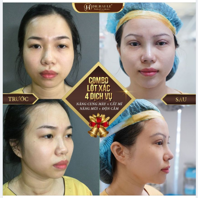 Phụ nữ sinh ra là để đẹp - Nếu chưa đẹp, chỉ là chúng ta chưa biết cách thay đổi.!!