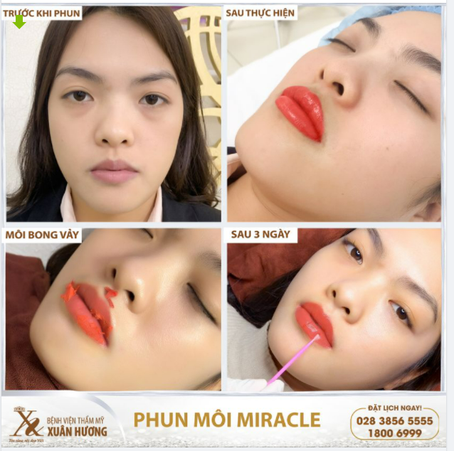 QUY TRÌNH "THAY ÁO MỚI" CHO ĐÔI MÔI CỦA KHÁCH HÀNG