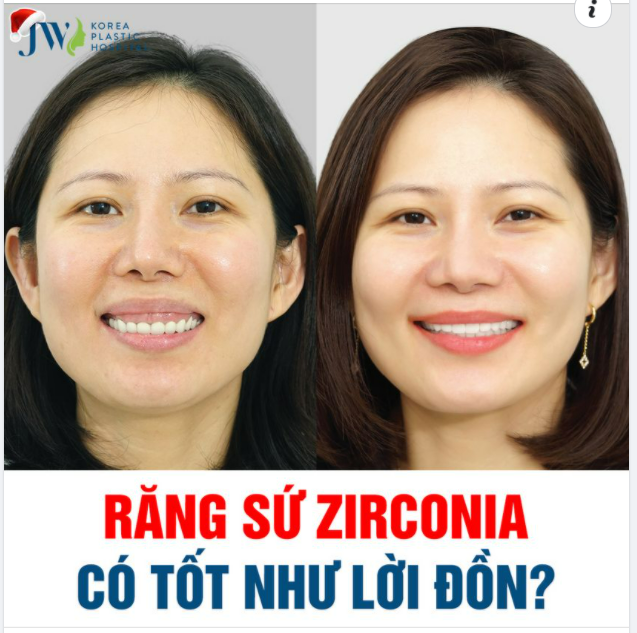 RĂNG SỨ ZIRCONIA CÓ TỐT NHƯ LỜI ĐỒN?