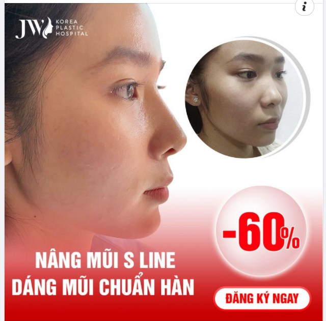 REVIEW CHIẾC MŨI VẠN NGƯỜI MÊ?