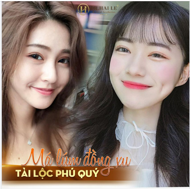 RƯỚC NGAY MAY MẮN TÀI LỘC VỚI THẨM MỸ TẠO MÁ LÚM ĐỒNG TIỀN!