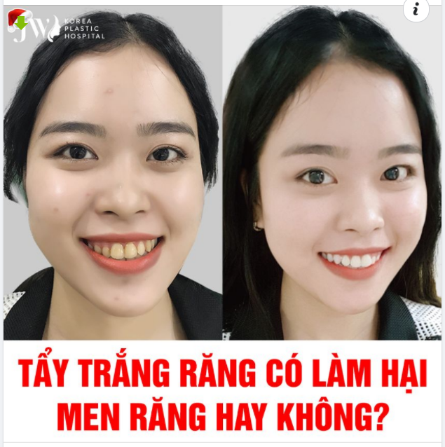 TẨY TRẮNG RĂNG CÓ LÀM HẠI MEN RĂNG HAY KHÔNG?