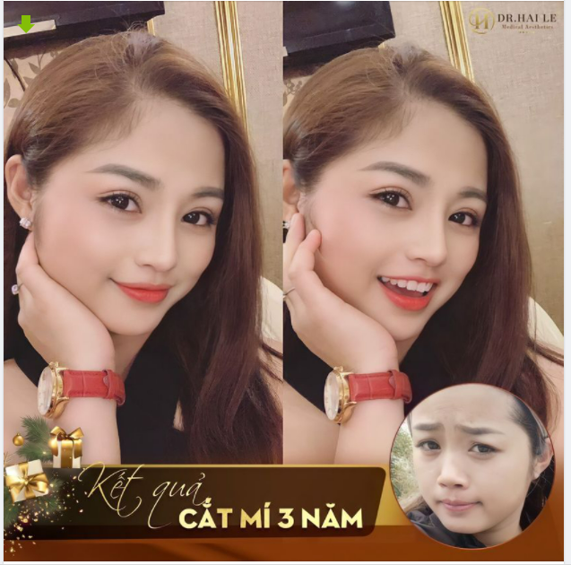 THẦN THÁI RẠNG RỠ VỚI NẾP MÍ 3 NĂM TUỔI.