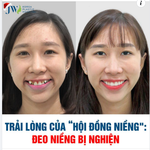 TRẢI LÒNG CỦA HỘI “ĐỒNG NIỀNG": ĐEO NIỀNG BỊ NGHIỆN?