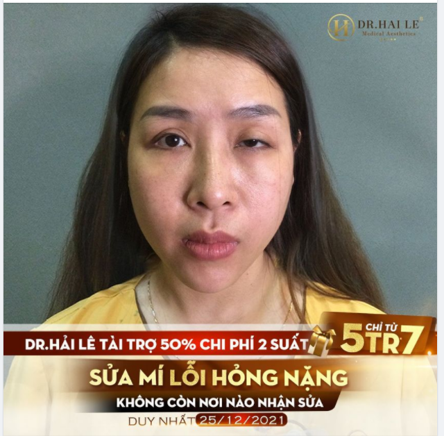 Trên đời này có hai thứ không thể bỏ lỡ!! Đó là chuyến tàu cuối cùng về nhà và hai là ưu đãi xịn nhà Dr.Hải Lê vào dịp Noel.