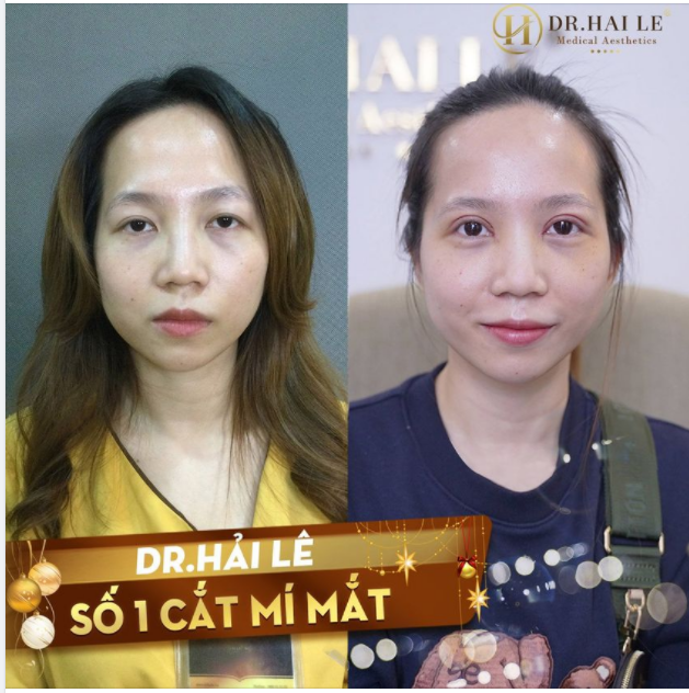 TRỞ THÀNH PHIÊN BẢN HOÀN HẢO NHẤT CỦA CHÍNH MÌNH.!!