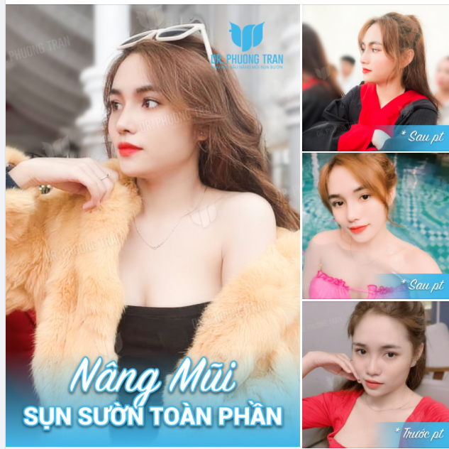 Trời xanh, mây trắng, nắng vàng Không bằng anh bước được vào tim em