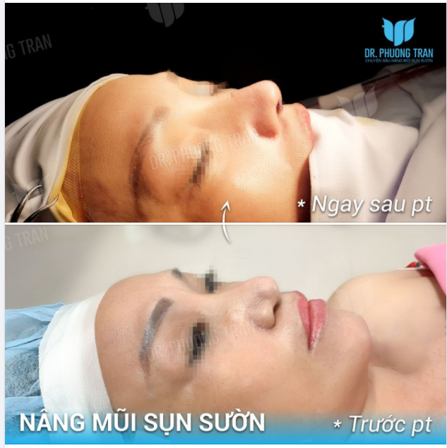 TỪ ẤY TRONG TÔI BỪNG NẮNG HẠ…