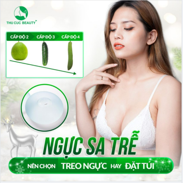 V1 SA TRỄ NÊN CHỌN TREO NGỰC HAY ĐẶT TÚI?