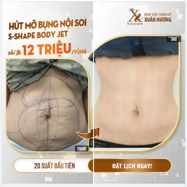 VÌ CON - MẸ TỪ BỎ EO THON
