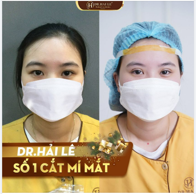 XINH ĐẸP HƠN BỘI PHẦN CHỈ NHỜ MỘT THAY ĐỔI NHỎ Ở ĐÔI MẮT!