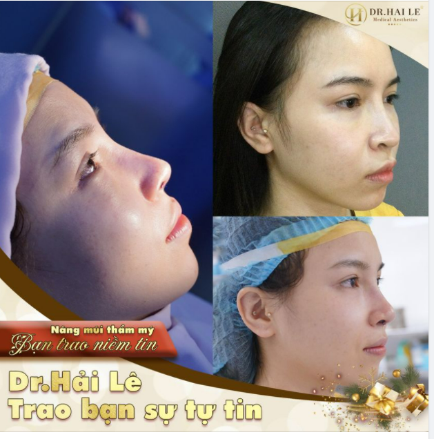 Xinh đẹp không phải may mắn, đó là lựa chọn