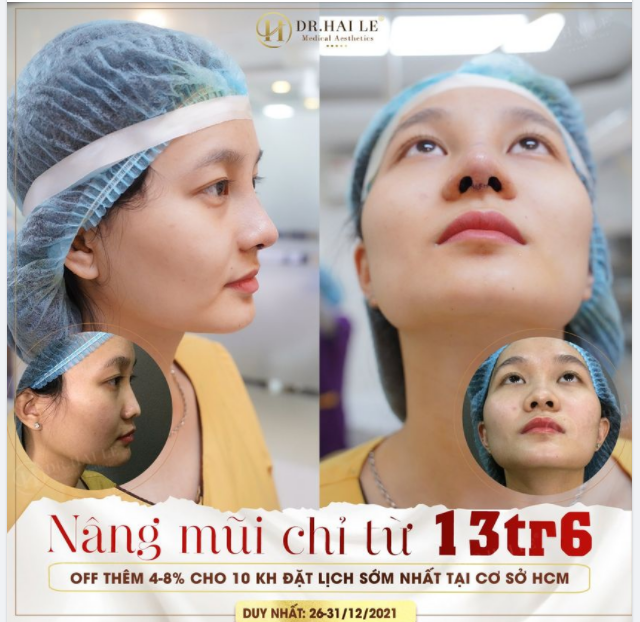 45p mũi Mediform tài lộc Ngủ 1 giấc là có ngay mũi đẹp là có thật.