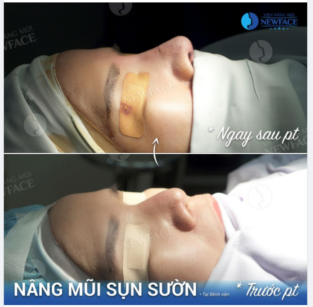 “BÁC SĨ LÀM SAO TRÔNG EM ĐƯỢC GIỐNG NGƯỜI TA”