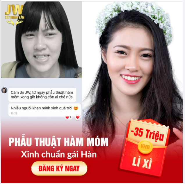CHẤN ĐỘNG BỆNH VIỆN JW BỊ KHÁCH RÉO TÊN VÌ PHẪU THUẬT HÀM MÓM ĐẸP XUẤT THẦN