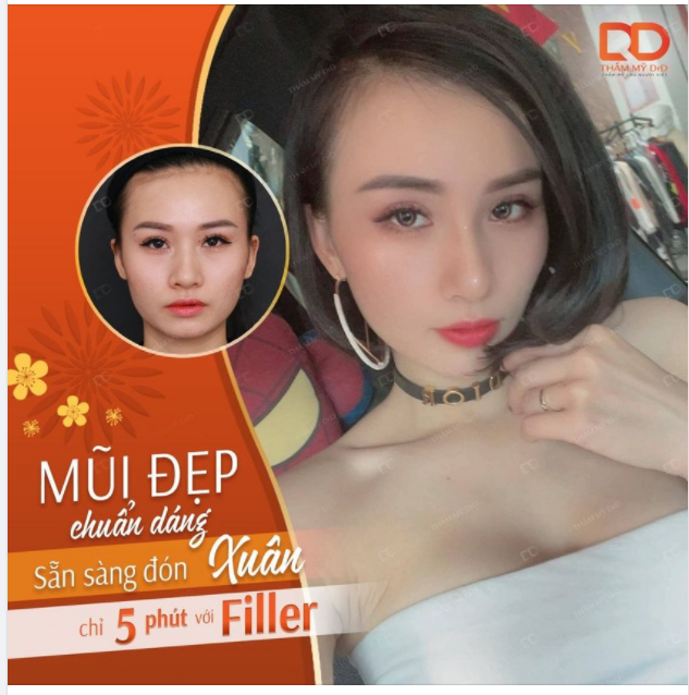 Chẳng còn mấy ngày nữa mà Tết, Nâng mũi bằng Filler chính là phương pháp làm đẹp được yêu thích nhất.