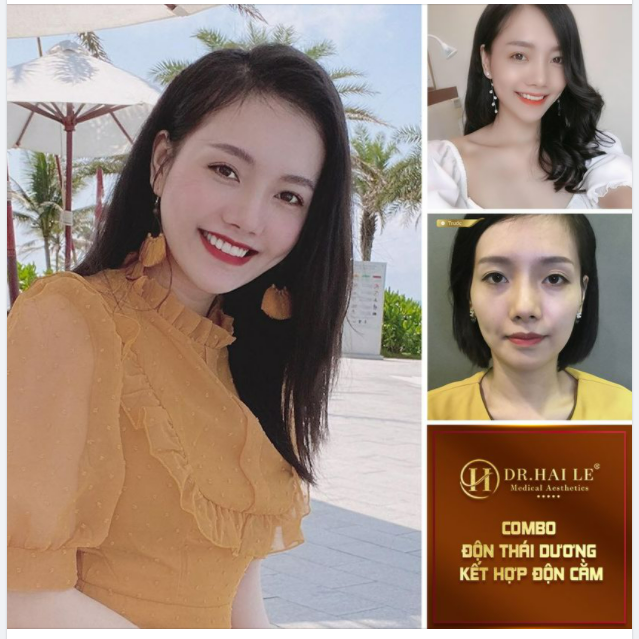 COMBO ĐỘN THÁI DƯƠNG KẾT HỢP ĐỘN CẰM -  VƯỢNG TƯỚNG SỐ!