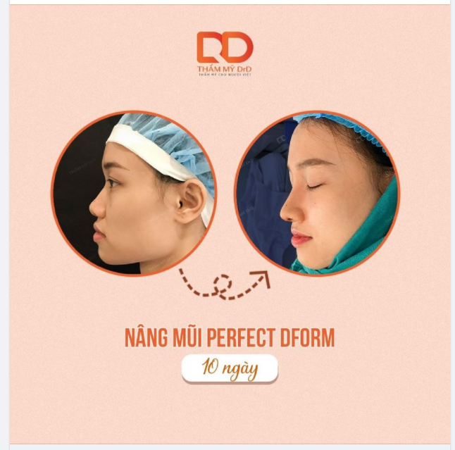 ĐỔI DÁNG MŨI PHONG THỦY, ĐÓN NĂM MỚI RỰC RỠ