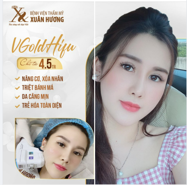 DỌN NHÀ ĐÓN TẾT ĐỪNG QUÊN DỌN CẢ NẾP NHĂN TRÊN LÀN DA