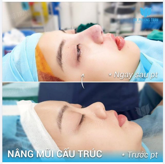 Em không còn thấy lòng giông bão nữa Bởi từ nay em đã có nụ cười