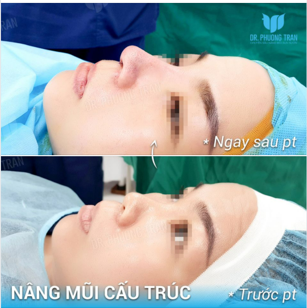 Gửi bạn, người có trái tim vô cùng nhạy cảm…