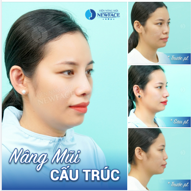 HÃY QUAN SÁT GÓC NGHIÊNG ĐỂ THẤY SỰ KHÁC BIỆT