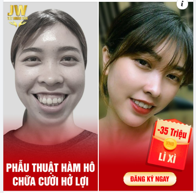 HẾT HÔ HẾT HỞ LỢI THÊM NỤ CƯỜI THÊM NIỀM VUI