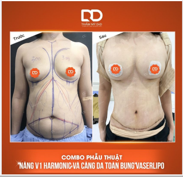 Hoàn thành xuất sắc thiên chức làm mẹ, giờ là lúc chị gái 2 con đầu tư vào bản thân mình.