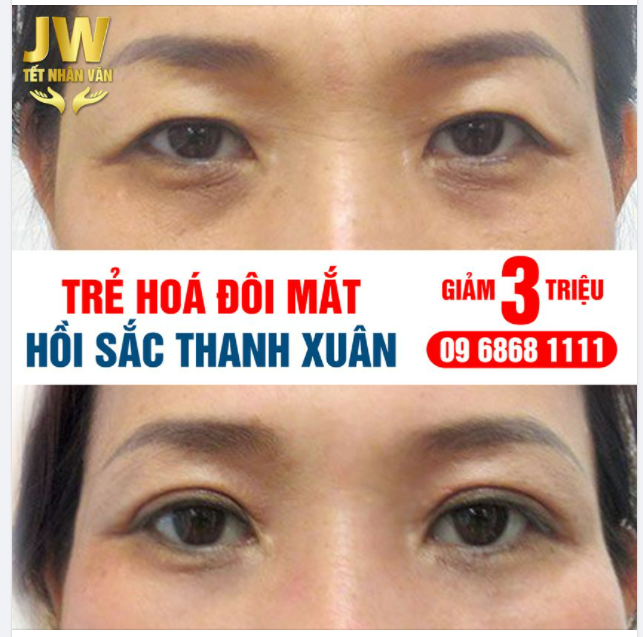 HỒI XUÂN ĐÔI MẮT - ĐẸP XUẤT SẮC ĐÓN XUÂN SANG